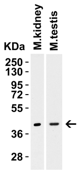 HAVCR1 Antibody