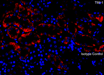 HAVCR1 Antibody