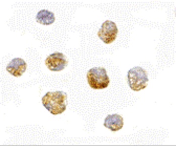 HUWE1 Antibody