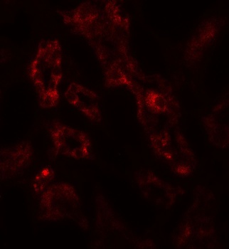 ARF6 Antibody