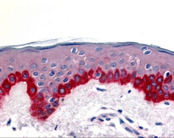 APAF1 Antibody