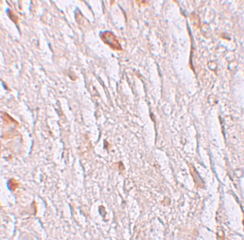 ZIP7 Antibody