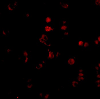 AATF Antibody