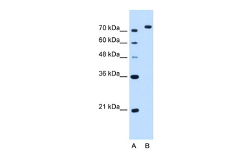 NOLC1 Antibody