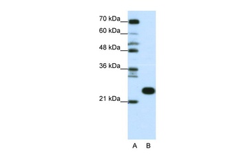 RPL13 Antibody