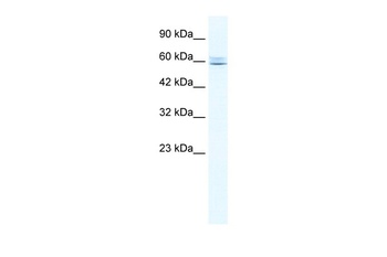 CBFA2T3 Antibody