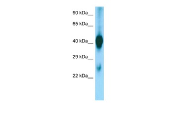 ASGR1 Antibody