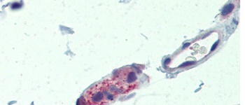 TNKS Antibody