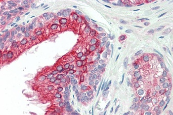TNKS2 Antibody
