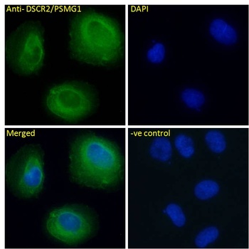 ZEB1 Antibody