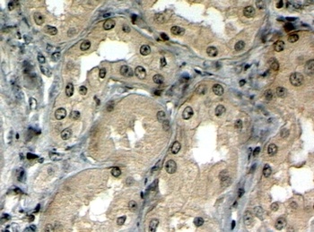 PRUNE2 Antibody