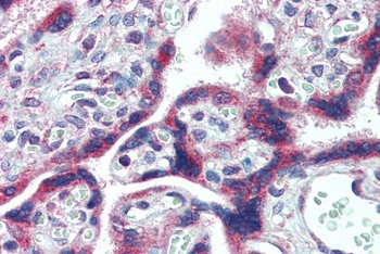 DYX1C1 Antibody
