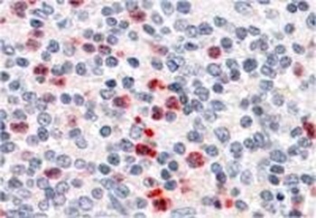 CHRNB1 Antibody