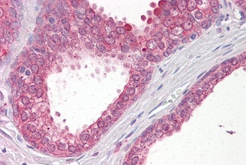 VPS41 Antibody