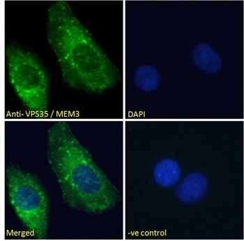 VPS35 Antibody