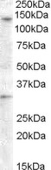 Vitamin D-binding Protein Antibody