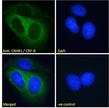 HNF1B Antibody