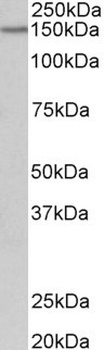 CDH1 Antibody