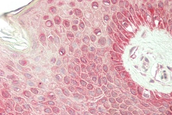 CDH1 Antibody