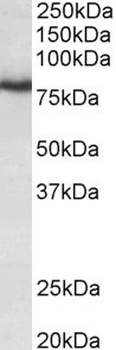 CDH1 Antibody