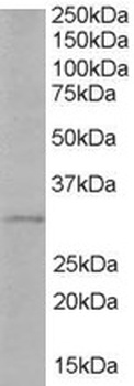 TIRAP Antibody