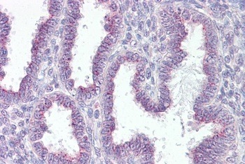 TGM2 Antibody