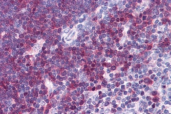 STMN1 Antibody