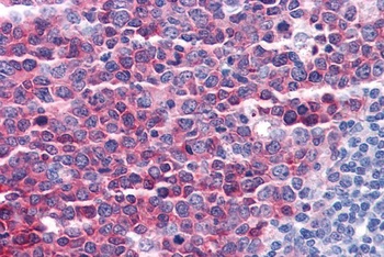 STMN1 Antibody