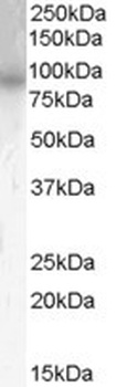 STMN1 Antibody