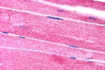 SORBS1 Antibody