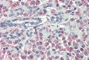 TTR Antibody