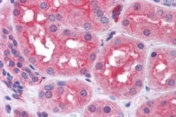 TTR Antibody