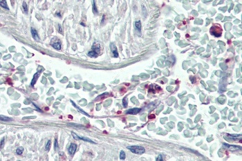 PLEK Antibody