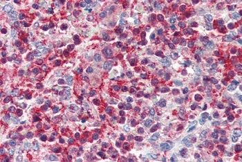 PLEK Antibody
