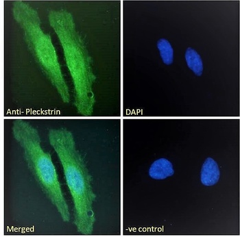 PLEK Antibody