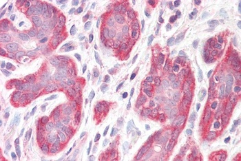 PDLIM4 Antibody
