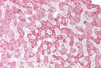 OSBPL5 Antibody