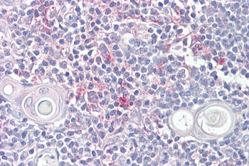 nf2b Antibody