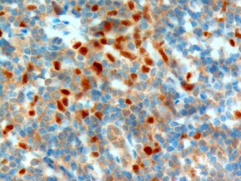 NET1 Antibody