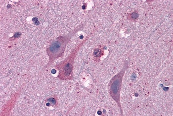 MYRIP Antibody