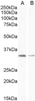 MDM2 Antibody