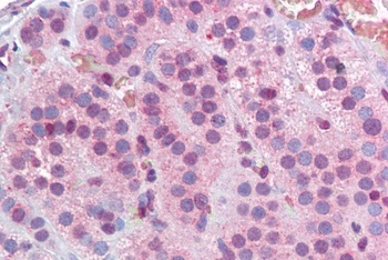 MBD2 Antibody