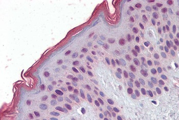 MBD2 Antibody