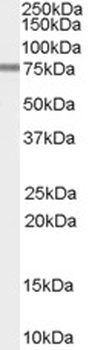 MBD2 Antibody
