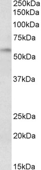 MBD2 Antibody