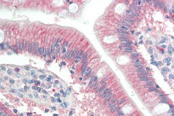 RNF39 Antibody