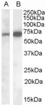 SLC12A4 Antibody