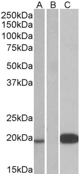 Il12 beta Antibody