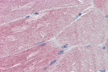 IGFBP6 Antibody