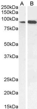 IFT88 Antibody
